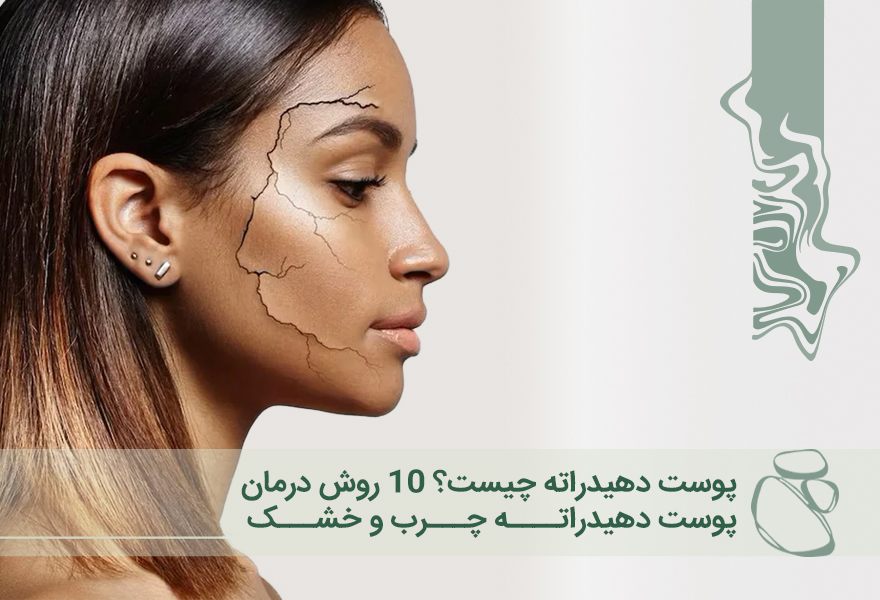 پوست دهیدراته چیست؟ 10 روش درمان پوست دهیدراته چرب و خشک